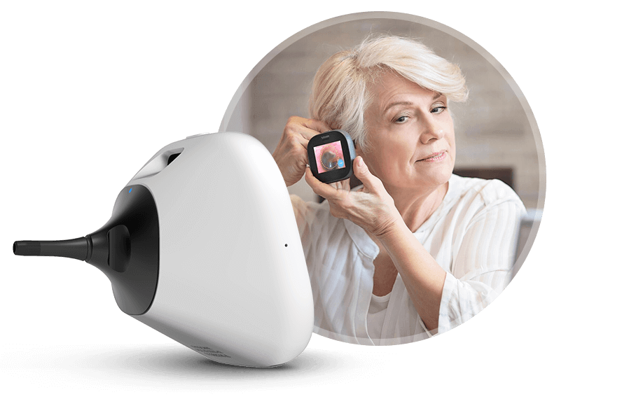 Tyto Ear Exam Device
